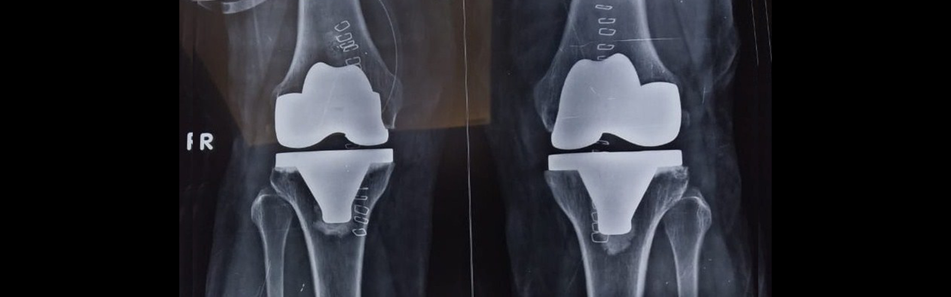 Patankar Ortho Care